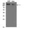 Collagen Type I Alpha 2 Chain antibody, STJ98600, St John