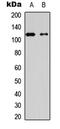 Hexokinase 1 antibody, abx121415, Abbexa, Western Blot image 