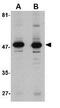Aldehyde Dehydrogenase 3 Family Member A1 antibody, GTX31778, GeneTex, Western Blot image 