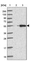 Calcium Binding Tyrosine Phosphorylation Regulated antibody, PA5-61593, Invitrogen Antibodies, Western Blot image 