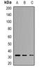 Tryptase Alpha/Beta 1 antibody, orb340812, Biorbyt, Western Blot image 