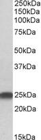 Lin-7 Homolog B, Crumbs Cell Polarity Complex Component antibody, 45-832, ProSci, Western Blot image 