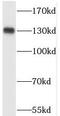 PDS5 Cohesin Associated Factor A antibody, FNab06290, FineTest, Western Blot image 