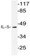 Interleukin 5 antibody, AP20595PU-N, Origene, Western Blot image 
