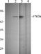 Signal Transducer And Activator Of Transcription 1 antibody, 700349, Invitrogen Antibodies, Western Blot image 