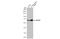 NOP58 Ribonucleoprotein antibody, GTX116419, GeneTex, Western Blot image 