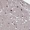 Anoctamin 10 antibody, PA5-62435, Invitrogen Antibodies, Immunohistochemistry frozen image 