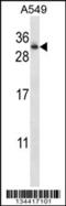 RAB11A, Member RAS Oncogene Family antibody, 57-792, ProSci, Western Blot image 