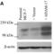 ADAM Metallopeptidase Domain 17 antibody, A00604-1, Boster Biological Technology, Western Blot image 