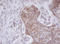 Mitochondrial Translational Initiation Factor 3 antibody, LS-C788777, Lifespan Biosciences, Immunohistochemistry paraffin image 