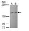 Phosphoinositide-3-Kinase Regulatory Subunit 4 antibody, PA5-28917, Invitrogen Antibodies, Western Blot image 