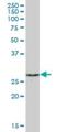 Proteasome 26S Subunit, Non-ATPase 9 antibody, H00005715-B01P, Novus Biologicals, Western Blot image 