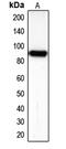 Cadherin 16 antibody, MBS822267, MyBioSource, Western Blot image 