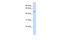 Transmembrane Protein 266 antibody, 26-711, ProSci, Western Blot image 