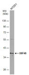 DBF4 Zinc Finger B antibody, GTX120796, GeneTex, Western Blot image 