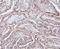 DNA Topoisomerase II Alpha antibody, A00953, Boster Biological Technology, Immunohistochemistry paraffin image 