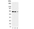 Solute Carrier Family 1 Member 6 antibody, R31367, NSJ Bioreagents, Western Blot image 