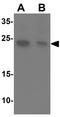 Tctex1 domain-containing protein 2 antibody, GTX31489, GeneTex, Western Blot image 