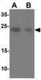 Tctex1 Domain Containing 2 antibody, GTX31489, GeneTex, Western Blot image 