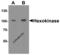 Hexokinase 1 antibody, 8217, ProSci Inc, Western Blot image 