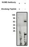 NUMB Endocytic Adaptor Protein antibody, AP05298PU-N, Origene, Western Blot image 