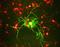 Neurofilament Medium antibody, LS-C204561, Lifespan Biosciences, Immunocytochemistry image 