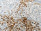 Coagulation Factor XIII A Chain antibody, CSB-PA285910, Cusabio, Immunohistochemistry paraffin image 