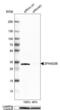 Zinc Finger AN1-Type Containing 2B antibody, NBP1-89174, Novus Biologicals, Western Blot image 