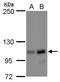 Nucleolar And Coiled-Body Phosphoprotein 1 antibody, GTX115205, GeneTex, Western Blot image 