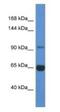 Mannosidase Alpha Class 2A Member 2 antibody, NBP1-74213, Novus Biologicals, Western Blot image 