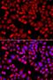 Actin Related Protein 2/3 Complex Subunit 3 antibody, orb373750, Biorbyt, Immunofluorescence image 