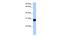 SLAM family member 6 antibody, PA5-43523, Invitrogen Antibodies, Western Blot image 