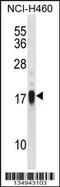 CD70 Molecule antibody, 57-954, ProSci, Western Blot image 