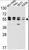 Inosine Monophosphate Dehydrogenase 2 antibody, AP17504PU-N, Origene, Western Blot image 