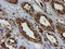 Proteasome Subunit Beta 9 antibody, LS-C337657, Lifespan Biosciences, Immunohistochemistry paraffin image 