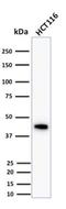 Keratin 18 antibody, NBP2-29461, Novus Biologicals, Western Blot image 