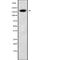 Alsin Rho Guanine Nucleotide Exchange Factor ALS2 antibody, abx148157, Abbexa, Western Blot image 
