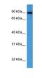 Oxysterol Binding Protein antibody, orb331090, Biorbyt, Western Blot image 