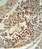 Kruppel Like Factor 5 antibody, A00727, Boster Biological Technology, Immunohistochemistry paraffin image 