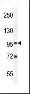 Glycosylphosphatidylinositol Specific Phospholipase D1 antibody, 61-395, ProSci, Western Blot image 