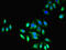 Transient Receptor Potential Cation Channel Subfamily M Member 2 antibody, orb23858, Biorbyt, Immunocytochemistry image 