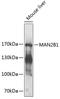 Mannosidase Alpha Class 2B Member 1 antibody, 23-985, ProSci, Western Blot image 