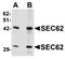 SEC62 Homolog, Preprotein Translocation Factor antibody, orb75658, Biorbyt, Western Blot image 