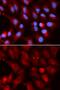 Proteasome Subunit Beta 2 antibody, GTX54633, GeneTex, Immunofluorescence image 