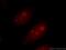 Apoptosis Antagonizing Transcription Factor antibody, 10282-1-AP, Proteintech Group, Immunofluorescence image 