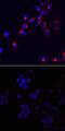 C-C Motif Chemokine Ligand 3 antibody, MA5-24364, Invitrogen Antibodies, Immunocytochemistry image 