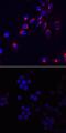 P10855 antibody, MA5-24364, Invitrogen Antibodies, Immunocytochemistry image 