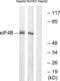 Eukaryotic Translation Initiation Factor 4B antibody, LS-C198911, Lifespan Biosciences, Western Blot image 