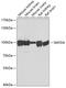 SET And MYND Domain Containing 4 antibody, GTX32886, GeneTex, Western Blot image 
