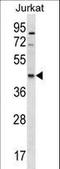 Glycerophosphodiester Phosphodiesterase 1 antibody, LS-C159723, Lifespan Biosciences, Western Blot image 